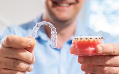 The Difference Between Invisalign and Braces: Everything to Consider