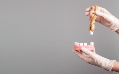 Wisdom Teeth Removal: What You Need To Know
