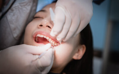 Extracting Wisdom: A Comprehensive Guide to Wisdom Teeth Removal
