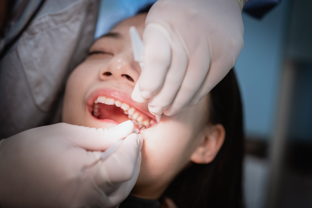 Woman Getting Her Wisdom Tooth Removed