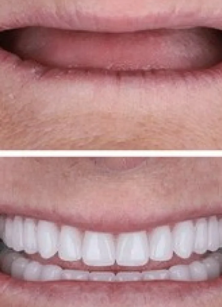 Frame 1618873204 scaled.webp